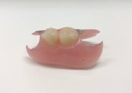 ノンクラスプデンチャー